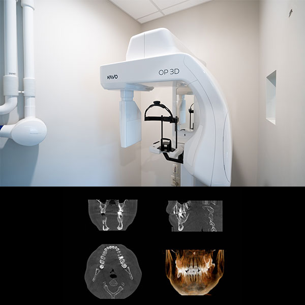 cone beam